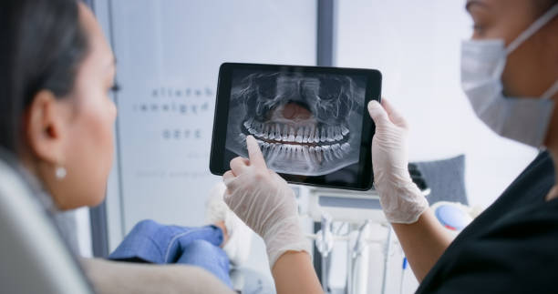 Licensed Root Canal Treatment service in Falmouth Foreside, ME - Smile Center Dentistry